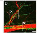 Chicken IgY (H+L) Secondary Antibody in Immunohistochemistry (IHC)
