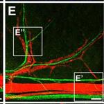 Chicken IgY (H+L) Secondary Antibody in Immunohistochemistry (IHC)