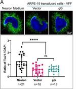 Mouse IgG (H+L) Highly Cross-Adsorbed Secondary Antibody in Immunocytochemistry (ICC/IF)