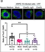 Mouse IgG (H+L) Highly Cross-Adsorbed Secondary Antibody in Immunocytochemistry (ICC/IF)