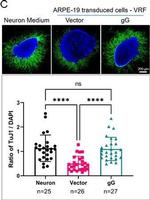 Mouse IgG (H+L) Highly Cross-Adsorbed Secondary Antibody in Immunocytochemistry (ICC/IF)