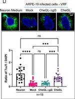 Mouse IgG (H+L) Highly Cross-Adsorbed Secondary Antibody in Immunocytochemistry (ICC/IF)
