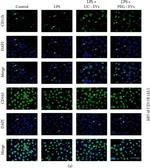 Rabbit IgG (H+L) Highly Cross-Adsorbed Secondary Antibody in Immunocytochemistry (ICC/IF)