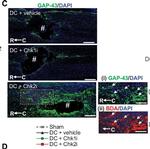 Mouse IgG1 Cross-Adsorbed Secondary Antibody in Immunohistochemistry (IHC)