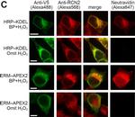 Mouse IgG (H+L) Highly Cross-Adsorbed Secondary Antibody in Immunocytochemistry (ICC/IF)