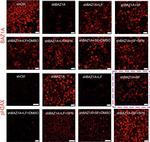 Rabbit IgG (H+L) Highly Cross-Adsorbed Secondary Antibody in Immunocytochemistry (ICC/IF)