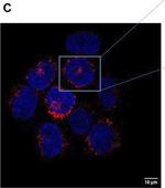 Rabbit IgG (H+L) Cross-Adsorbed Secondary Antibody in Immunocytochemistry (ICC/IF)