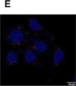 Rabbit IgG (H+L) Cross-Adsorbed Secondary Antibody in Immunocytochemistry (ICC/IF)