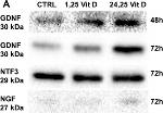 Rabbit IgG (H+L) Secondary Antibody in Western Blot (WB)