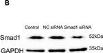 Rabbit IgG (H+L) Secondary Antibody in Western Blot (WB)