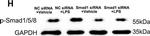 Mouse IgG (H+L) Secondary Antibody in Western Blot (WB)