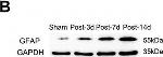 Mouse IgG (H+L) Secondary Antibody in Western Blot (WB)