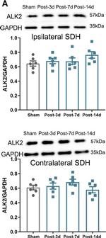 Rabbit IgG (H+L) Secondary Antibody in Western Blot (WB)