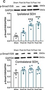 Rabbit IgG (H+L) Secondary Antibody in Western Blot (WB)