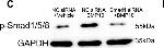Rabbit IgG (H+L) Secondary Antibody in Western Blot (WB)