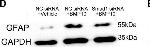 Mouse IgG (H+L) Secondary Antibody in Western Blot (WB)