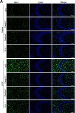 Rabbit IgG (H+L) Cross-Adsorbed Secondary Antibody in Immunohistochemistry (IHC)
