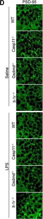 Rabbit IgG (H+L) Cross-Adsorbed Secondary Antibody in Immunohistochemistry (IHC)