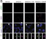 Rabbit IgG (H+L) Highly Cross-Adsorbed Secondary Antibody in Immunocytochemistry (ICC/IF)