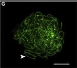Rabbit IgG (H+L) Cross-Adsorbed Secondary Antibody in Immunocytochemistry (ICC/IF)