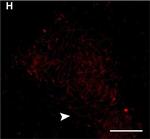 Chicken IgY (H+L) Secondary Antibody in Immunocytochemistry (ICC/IF)