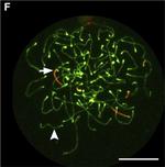 Rabbit IgG (H+L) Cross-Adsorbed Secondary Antibody in Immunocytochemistry (ICC/IF)