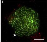 Rabbit IgG (H+L) Cross-Adsorbed Secondary Antibody in Immunocytochemistry (ICC/IF)