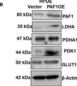 Rabbit IgG (H+L) Secondary Antibody in Western Blot (WB)