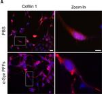 Rabbit IgG (H+L) Cross-Adsorbed Secondary Antibody in Immunocytochemistry (ICC/IF)