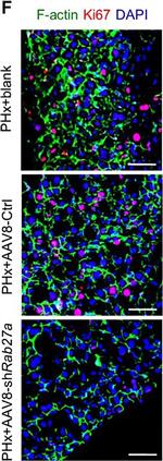 Rabbit IgG (H+L) Secondary Antibody in Immunohistochemistry (IHC)