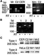 IP3 Receptor 1 Antibody in Western Blot (WB)