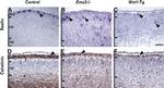 Calretinin Antibody in Immunohistochemistry (IHC)
