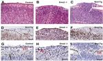 Calretinin Antibody in Immunohistochemistry (IHC)