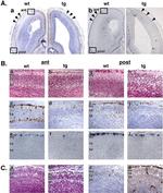 Calretinin Antibody in Immunohistochemistry (IHC)