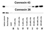 Connexin 26 Antibody in Western Blot (WB)