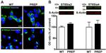 ST8SIA4 Antibody in Western Blot (WB)