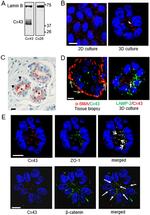 Connexin 26 Antibody in Western Blot (WB)
