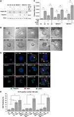Vimentin Antibody in Western Blot (WB)