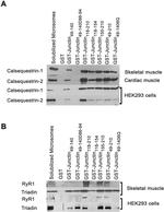 Calsequestrin Antibody in Western Blot (WB)