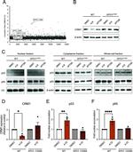CRM1 Antibody in Western Blot (WB)