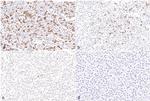 FOXP3 Antibody in Immunohistochemistry (IHC)