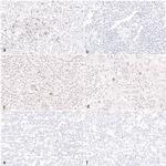 FOXP3 Antibody in Immunohistochemistry (IHC)