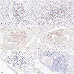 FOXP3 Antibody in Immunohistochemistry (IHC)