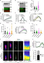 Nogo-B Antibody in Western Blot (WB)