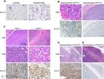 HLA-C Antibody in Immunohistochemistry (IHC)