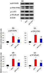 Phospho-NFkB p65 (Ser536) Antibody in Western Blot (WB)