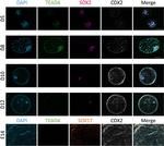 SOX2 Antibody in Immunohistochemistry (IHC)