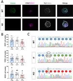 SOX2 Antibody in Immunohistochemistry (IHC)