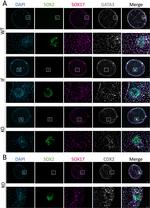 SOX2 Antibody in Immunohistochemistry (IHC)