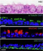 MUC5AC Antibody in Immunohistochemistry (Paraffin) (IHC (P))